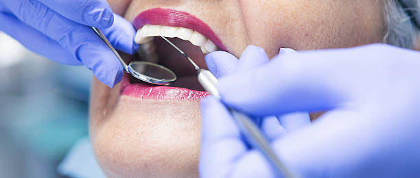 Best Emergency Dental Care for Broken or Chipped Teeth in Zephyrhills South, FL